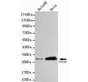 Western blot - SDCBP Monoclonal Antibody from Signalway Antibody (27105) - Antibodies.com