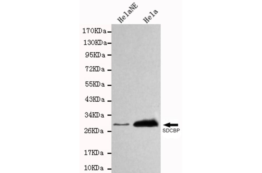 Western blot - SDCBP Monoclonal Antibody from Signalway Antibody (27105) - Antibodies.com