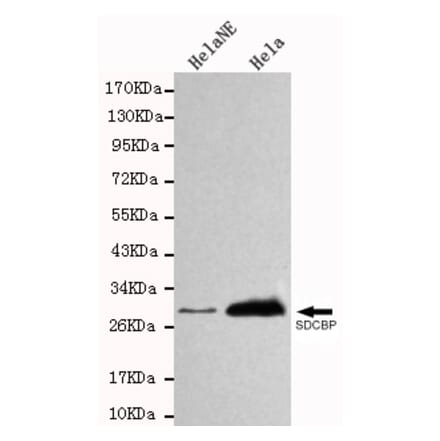 Western blot - SDCBP Monoclonal Antibody from Signalway Antibody (27105) - Antibodies.com