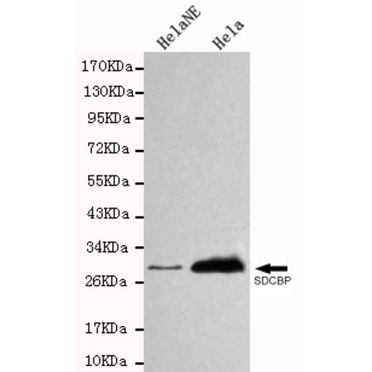 Western blot - SDCBP Monoclonal Antibody from Signalway Antibody (27105) - Antibodies.com