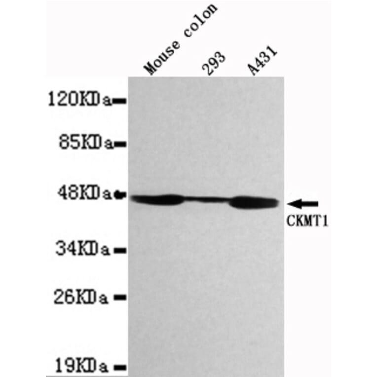Western blot - CKMT1 Monoclonal Antibody from Signalway Antibody (27110) - Antibodies.com