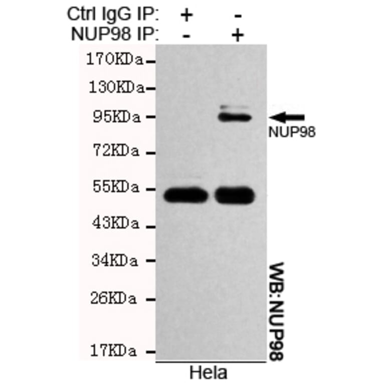 Immunoprecipitation - NUP98 Monoclonal Antibody from Signalway Antibody (27111) - Antibodies.com