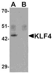 Western blot - KLF4 Monoclonal Antibody from Signalway Antibody (26047) - Antibodies.com