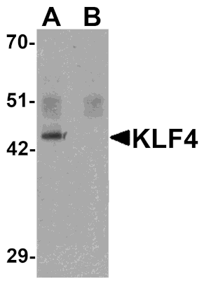 Western blot - KLF4 Monoclonal Antibody from Signalway Antibody (26047) - Antibodies.com