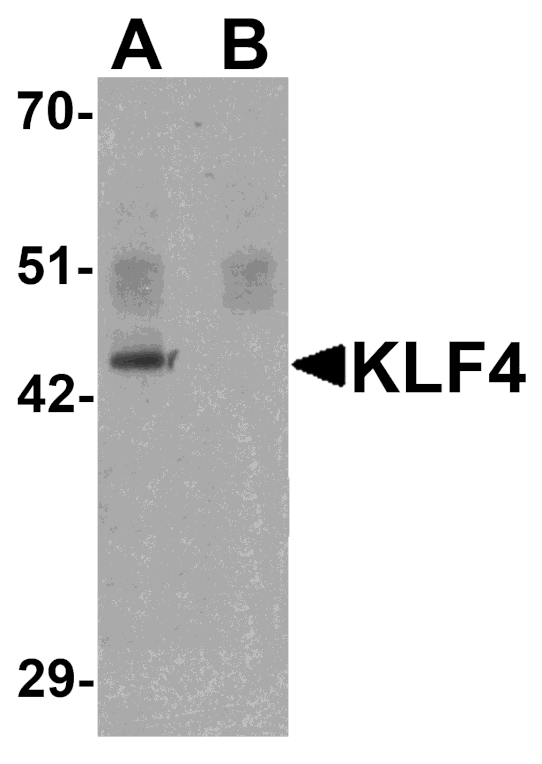 Western blot - KLF4 Monoclonal Antibody from Signalway Antibody (26047) - Antibodies.com