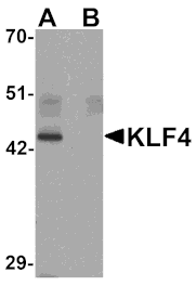 Western blot - KLF4 Monoclonal Antibody from Signalway Antibody (26048) - Antibodies.com