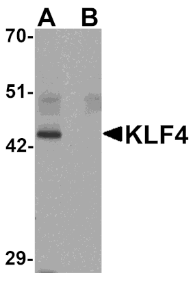 Western blot - KLF4 Monoclonal Antibody from Signalway Antibody (26048) - Antibodies.com
