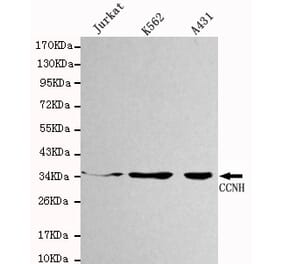 Western blot - CCNH Monoclonal Antibody from Signalway Antibody (27100) - Antibodies.com
