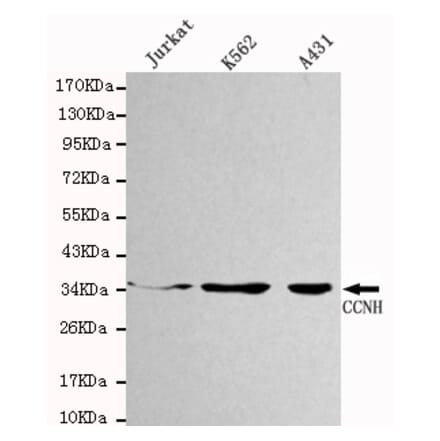 Western blot - CCNH Monoclonal Antibody from Signalway Antibody (27100) - Antibodies.com