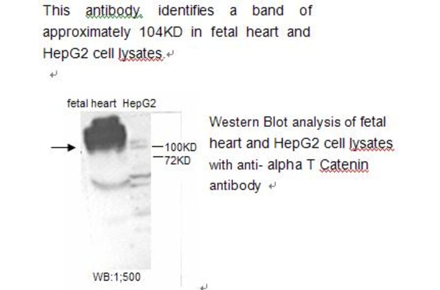 alpha T Catenin Antibody from Signalway Antibody (39216) - Antibodies.com