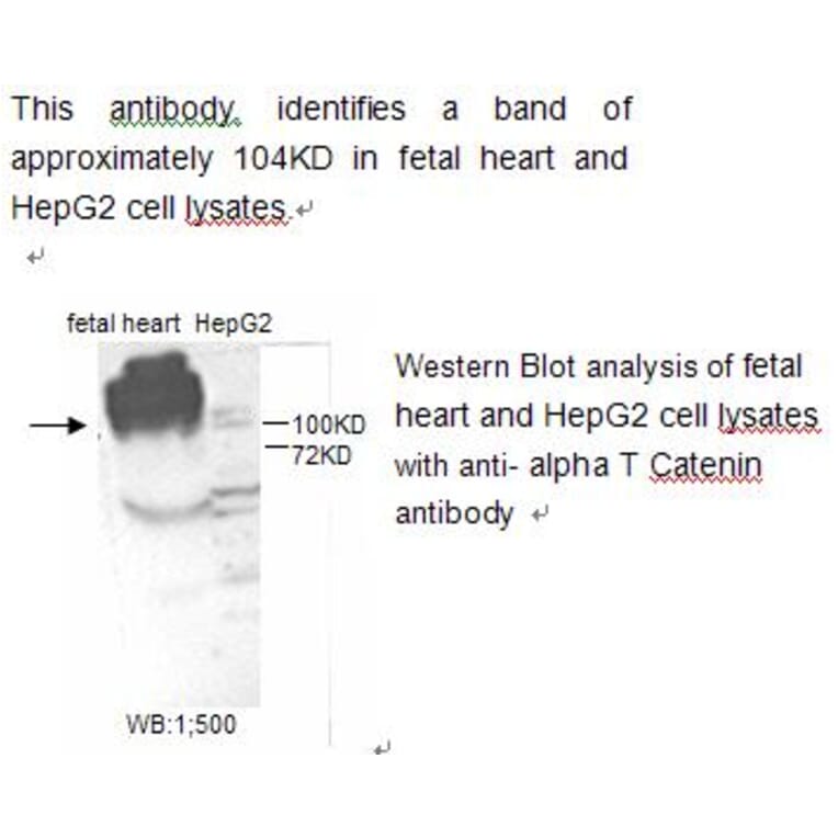 alpha T Catenin Antibody from Signalway Antibody (39216) - Antibodies.com
