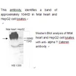 alpha T Catenin Antibody from Signalway Antibody (39216) - Antibodies.com