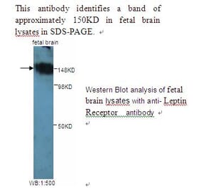Leptin Receptor Antibody from Signalway Antibody (39242) - Antibodies.com