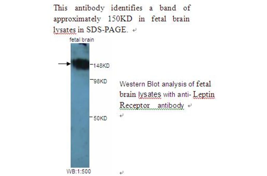Leptin Receptor Antibody from Signalway Antibody (39242) - Antibodies.com