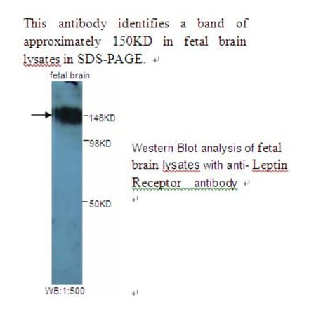 Leptin Receptor Antibody from Signalway Antibody (39242) - Antibodies.com