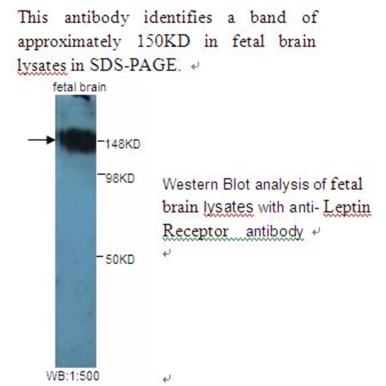 Leptin Receptor Antibody from Signalway Antibody (39242) - Antibodies.com
