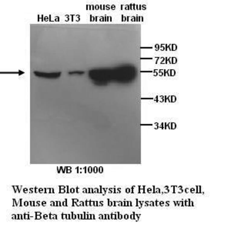 &beta;-Tubulin Antibody from Signalway Antibody (39299) - Antibodies.com