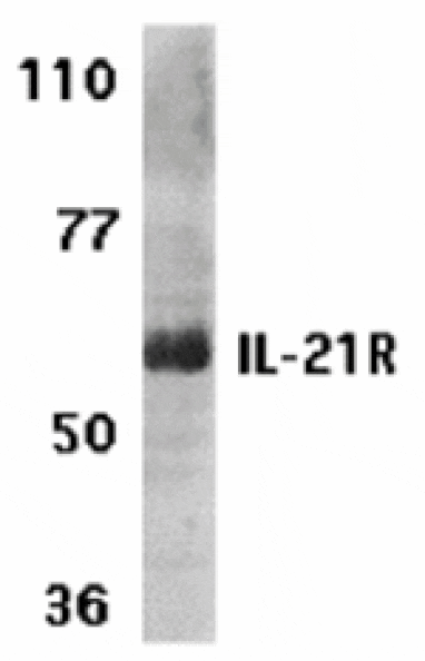 Western blot - IL-21 Receptor Antibody from Signalway Antibody (24145) - Antibodies.com
