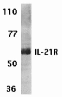 Western blot - IL-21 Receptor Antibody from Signalway Antibody (24145) - Antibodies.com