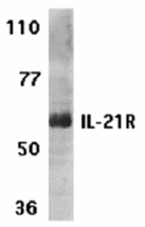 Western blot - IL-21 Receptor Antibody from Signalway Antibody (24145) - Antibodies.com
