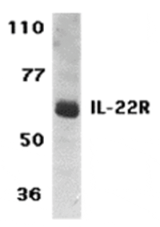 Western blot - IL-22 Receptor Antibody from Signalway Antibody (24149) - Antibodies.com