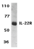 Western blot - IL-22 Receptor Antibody from Signalway Antibody (24149) - Antibodies.com
