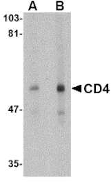 Western blot - CD4 Monoclonal Antibody from Signalway Antibody (26036) - Antibodies.com
