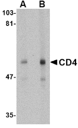 Western blot - CD4 Monoclonal Antibody from Signalway Antibody (26036) - Antibodies.com