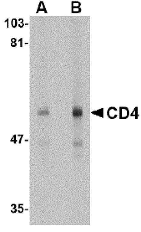 Western blot - CD4 Monoclonal Antibody from Signalway Antibody (26036) - Antibodies.com