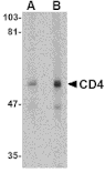 Western blot - CD4 Monoclonal Antibody from Signalway Antibody (26036) - Antibodies.com