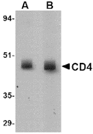 Western blot - CD4 Monoclonal Antibody from Signalway Antibody (26037) - Antibodies.com
