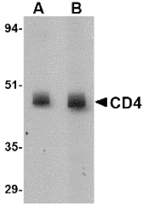 Western blot - CD4 Monoclonal Antibody from Signalway Antibody (26037) - Antibodies.com