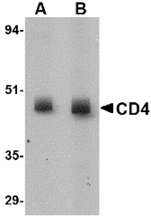 Western blot - CD4 Monoclonal Antibody from Signalway Antibody (26037) - Antibodies.com