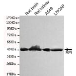 Western blot - MPI Monoclonal Antibody from Signalway Antibody (27091) - Antibodies.com