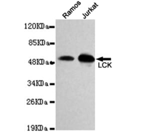 Western blot - LCK Monoclonal Antibody from Signalway Antibody (27118) - Antibodies.com
