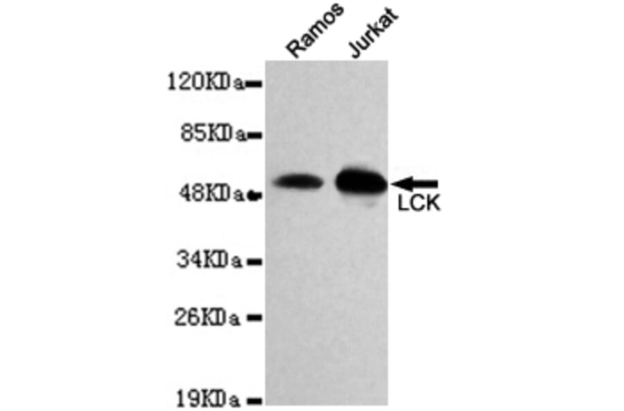 Western blot - LCK Monoclonal Antibody from Signalway Antibody (27118) - Antibodies.com