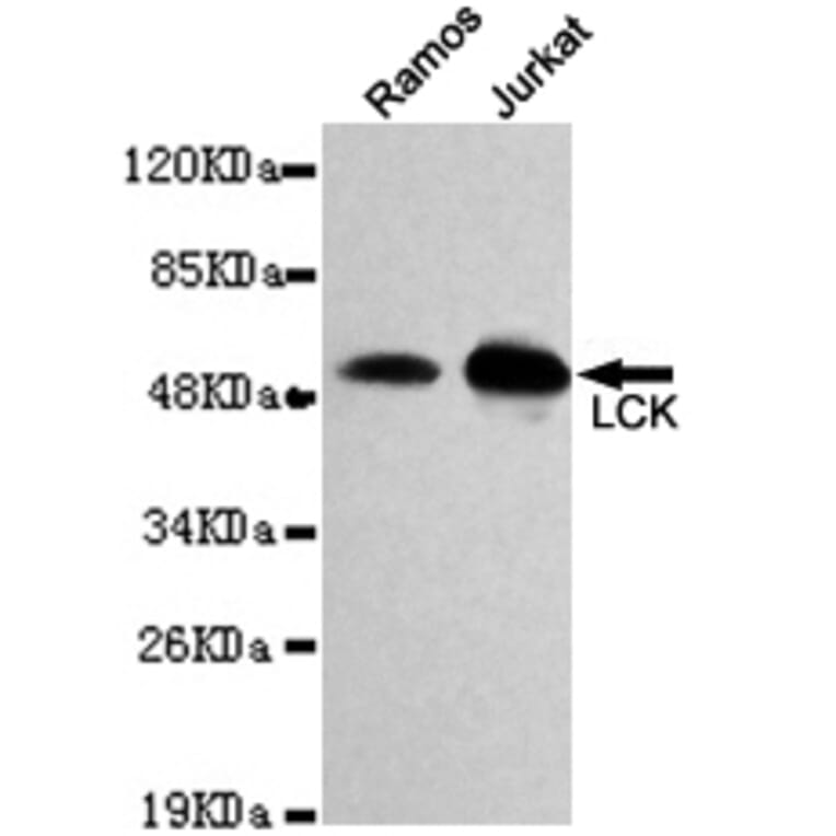 Western blot - LCK Monoclonal Antibody from Signalway Antibody (27118) - Antibodies.com
