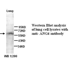angiopoietin 4 Antibody from Signalway Antibody (39292) - Antibodies.com