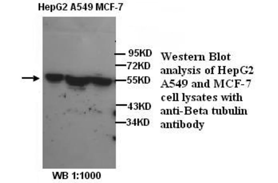 &beta;-Tubulin Antibody from Signalway Antibody (39298) - Antibodies.com