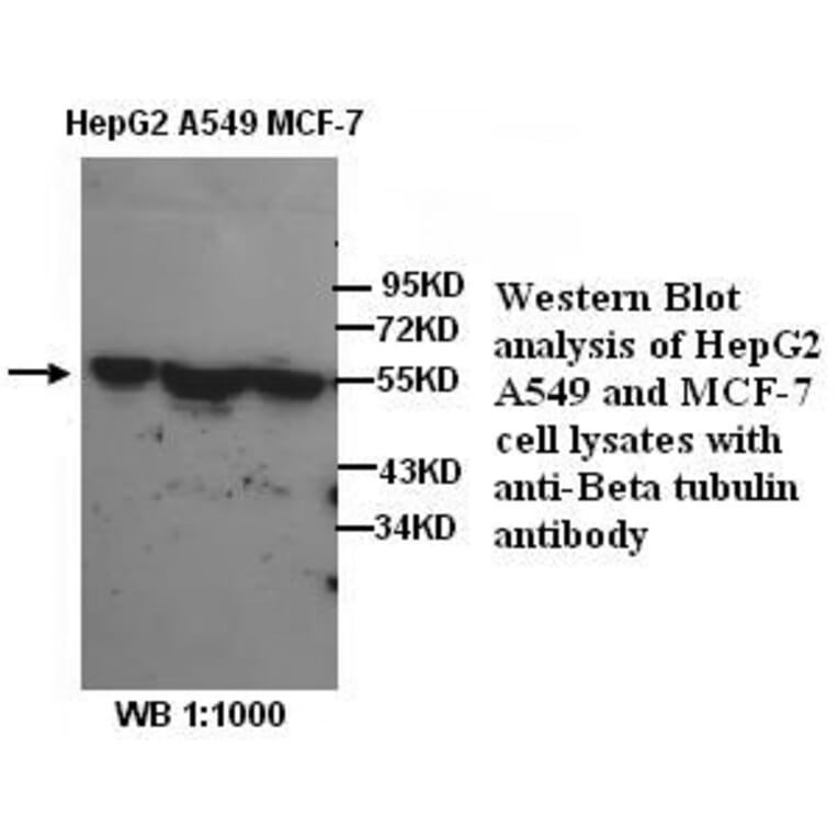 &beta;-Tubulin Antibody from Signalway Antibody (39298) - Antibodies.com