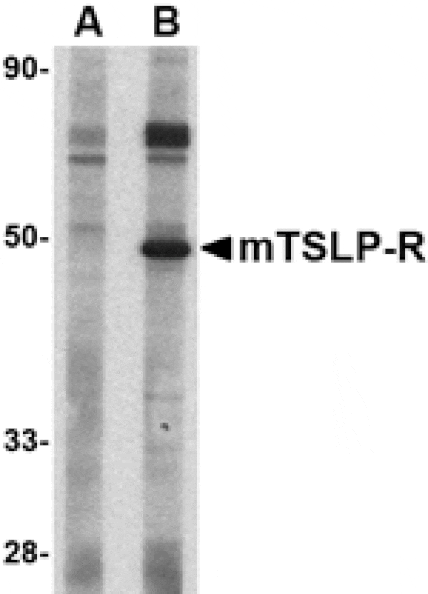 Western blot - TSLP Receptor Antibody from Signalway Antibody (24529) - Antibodies.com