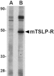 Western blot - TSLP Receptor Antibody from Signalway Antibody (24529) - Antibodies.com