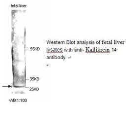 Kallikrein 14 Antibody from Signalway Antibody (39246) - Antibodies.com