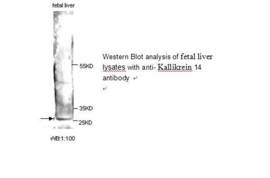 Kallikrein 14 Antibody from Signalway Antibody (39246) - Antibodies.com