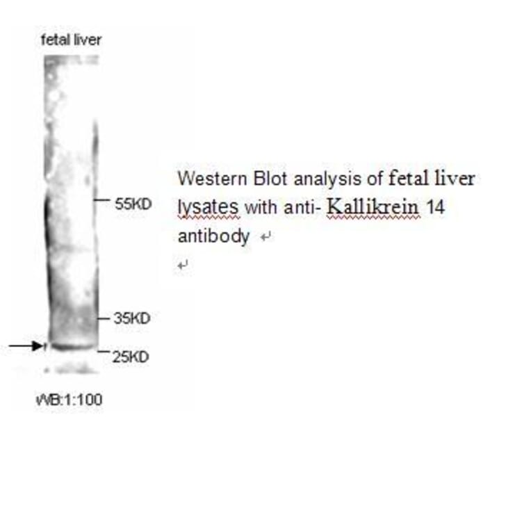 Kallikrein 14 Antibody from Signalway Antibody (39246) - Antibodies.com