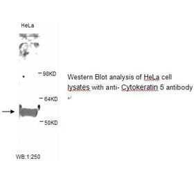 Cytokeratin 5 Antibody from Signalway Antibody (39247) - Antibodies.com