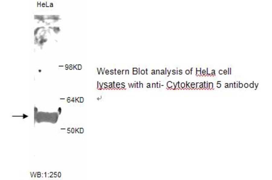 Cytokeratin 5 Antibody from Signalway Antibody (39247) - Antibodies.com