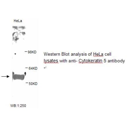 Cytokeratin 5 Antibody from Signalway Antibody (39247) - Antibodies.com