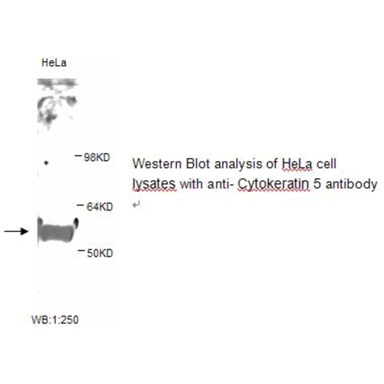 Cytokeratin 5 Antibody from Signalway Antibody (39247) - Antibodies.com