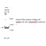 Cytokeratin 5 Antibody from Signalway Antibody (39247) - Antibodies.com